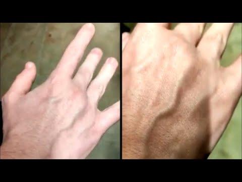 Man That Can Move His Veins. Your Daily Dose Of Internet. #Video