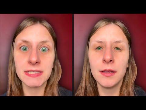 This Woman Can't Blink - Your Daily Dose Of Internet #Video