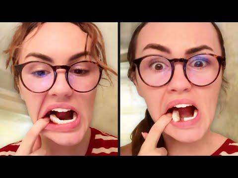 Teeth Aren't Supposed to Do This - Your Daily Dose Of Internet #Video