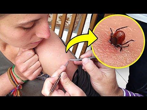 8 Most Poisonous Insects in the World