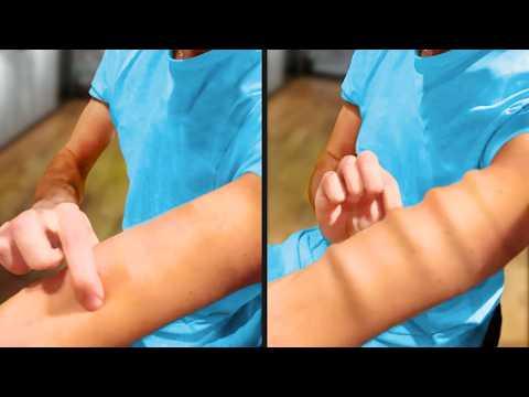 Arms Shouldn't Look Like This - Your Daily Dose Of Internet #Video