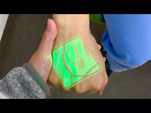 Using a Vein Finder Device. Your Daily Dose Of Internet. #Video
