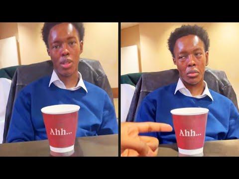 He Aged 30 Years in 10 Seconds | Your Daily Dose Of Internet #Video