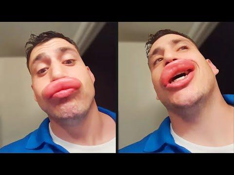 He Tried to Kiss a Bee - Your Daily Dose Of Internet #Video