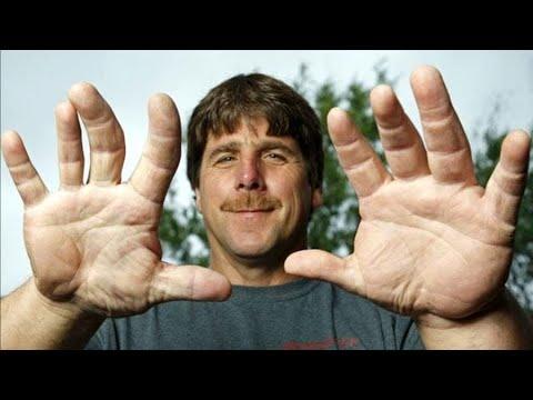 The Biggest Hands In The World. Your Daily Dose Of Internet Video.